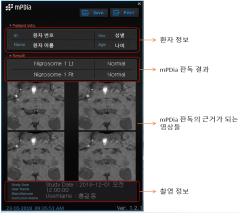 첨단기술 적용 혁신의료기기 2개 제품 추가 지정